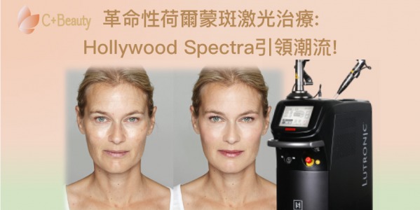 革命性荷爾蒙斑激光治療:Hollywood Spectra引領潮流!